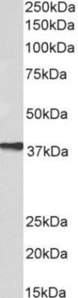 AIM2 Antibody (10M5G5) - Azide and BSA Free, Novus Biologicals 0.1 mg;